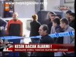 Kesik Bacak Alarmı!