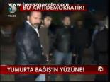 Yumurta Bağış'ın Yüzüne!