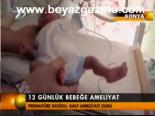 12 Günlük Bebeğe Ameliyat