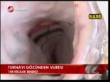 Turnayı Gözünden Vurdu