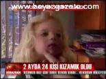 Kızamık Hortladı