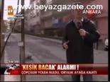 Kesik Bacak Alarmı!