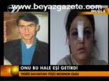 Onu Bu Hale Eşi Getirdi