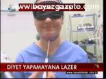 Diyet Yapamayana Lazer