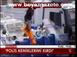 Polis Kemiklerini Kırdı