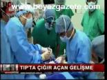 Tıp'ta Çığır Açan Gelişme