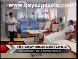 İlk Yapay Organ Nakli Yapıldı