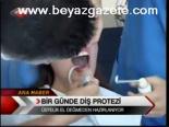 Bir Günde Diş Protezi