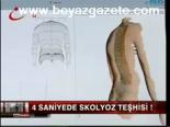 4 Saniyede Skolyoz Teşhisi