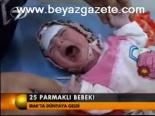 25 Parmaklı Bebek!