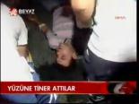 Yüzüne Tiner Attılar