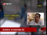 Alında Ayakkabı İzi