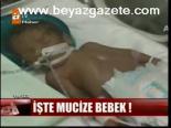İşte Mucize Bebek!