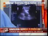 Kanserin Duman Olduğu An!
