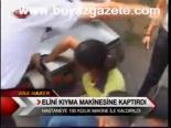 Elini Kıyma Makinesine Kaptırdı