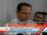 Böbreğinde 510 Taş Vardı