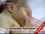 Sezaryen'e Partograf Engeli