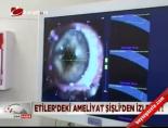 katarakt ameliyati - Etiler'deki ameliyat Şişli'den izlendi! Videosu