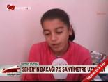 Seher'in Bacağı 7.5 Santimetre Uzatıldı