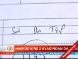 Hamide nine 2 ayağından da oldu