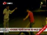 Askerde yediği dayak bu hale getirdi