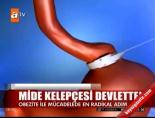 Mide Kelepçesi Devletten