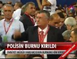 Polisin Burnu Kırıldı