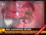 Mide kanserinde devrim