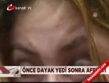 Önce dayak yedi sonra affetti