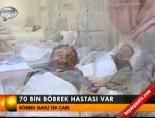 70 bin böbrek hastası var