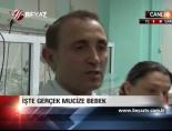 İşte Gerçek Mucize Bebek