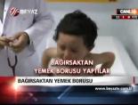 ameliyat - Bağırsaktan Yemek Borusu Videosu