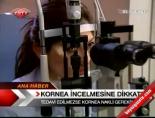 Kornea İncelmesine Dikkat
