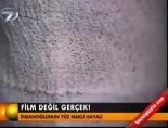 İnsanoğlunun yüz nakli hayali (Yüz Nakli Türkiye) online video izle