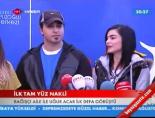 yuz nakli - Bağışçı aile Uğur'u gördü - Yüz Nakli Türkiye Videosu