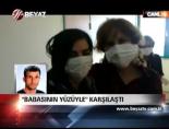 yuz nakli - Babasının Yüzüyle Karşılaştı- Yüz Nakli Türkiye Videosu