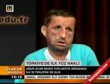 yuz nakli - Türkiye'de ilk yüz nakli Videosu