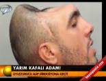 Yarım kafalı adam