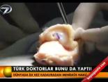 meniskus nakli - Türk doktorlar bunu da yaptı! Videosu