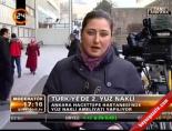 yuz nakli - Türkiye'de 2. yüz nakli Videosu