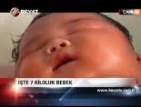 İşte 7 kiloluk bebek