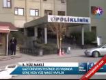 gazi universitesi - 3. Yüz Nakli Videosu