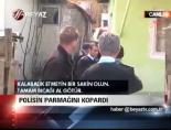 Polisin Parmağını Kopardı