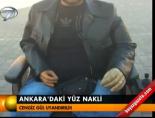 hacettepe universitesi - Ankara'daki yüz nakli Videosu