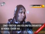 Beyninin üçte biri yok