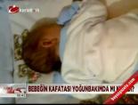 kafa kemigi - Bebeğin kafası yoğunbakımda mı kırıldı? Videosu