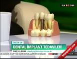 Diş Tedavisinde Uygulanan İmplat Bir Ameliyat Mıdır?