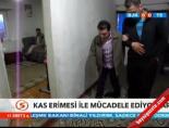 Kas Erimesi İle Mücadele Ediyorlar