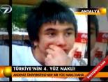 Türkiey'nin 4. yüz nakli online video izle