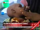 somali - Açlığın ve yokluğun ülkesi Somali Videosu